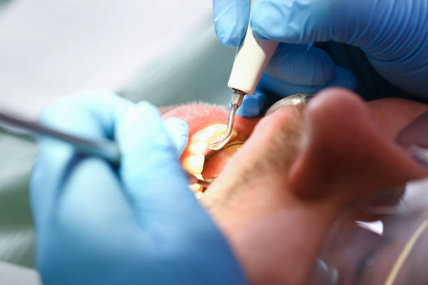 Best Emergency Treatment for Toothache in Wrangell, AK